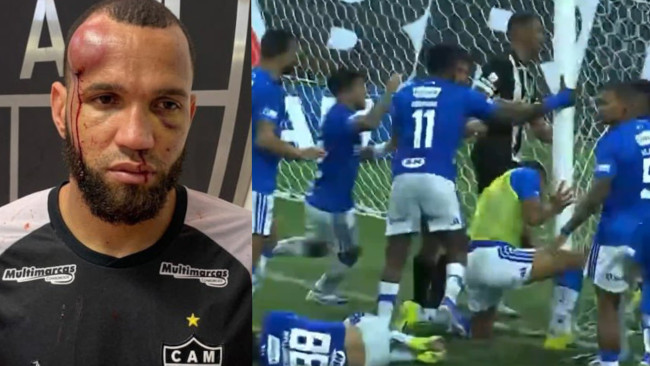 Une bataille rangée brutale au Brésil se termine par l'expulsion de 23 joueurs et des blessures graves.