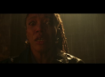 Une star montante doit subir un essai clinique d'enfer dans la bande-annonce officielle de &laquo; Clayface 