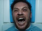 Tom Hardy partage une vidéo hilarante du tournage de Venom